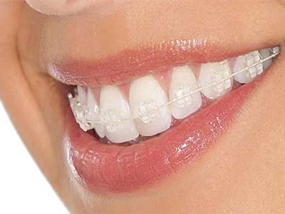aparelhos-esteticos2