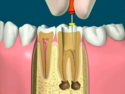endodontia-1