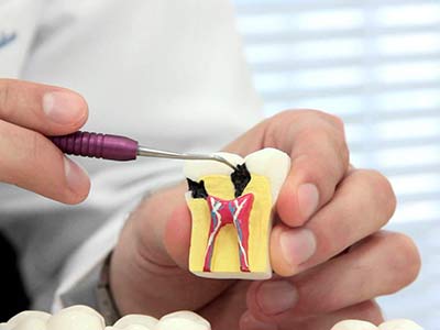 endodontia-3