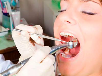 endodontia-4